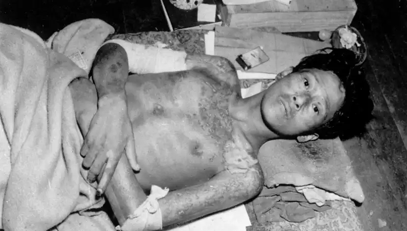 80 Yıl Sonra Nagasaki’den Gelen Şok Uyarı: Nükleer Tehdit Tehlikesi Giderek Artıyor!