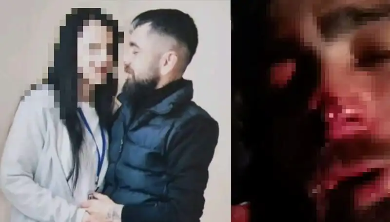 Eski Sevgiliye Uygulanan Şok Edici Şiddet Olayı: Kulağı ve Burnu Koparıldı