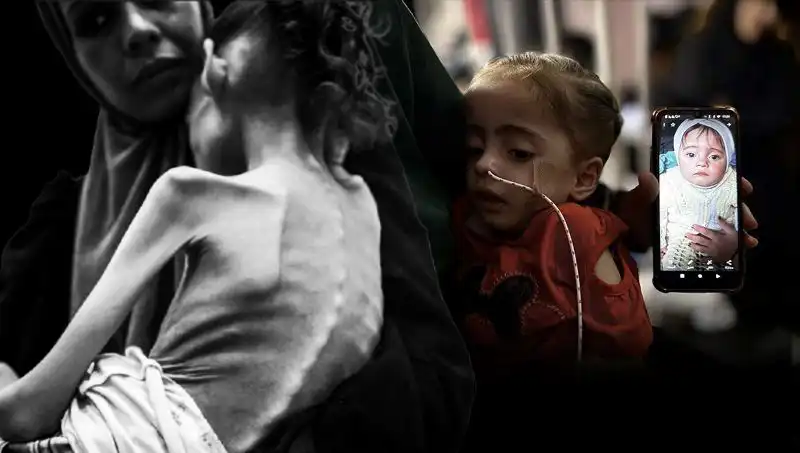 Küçük Meryem'in Zorlu Mücadelesi: 25 Kilodan 10 Kiloya Düştü